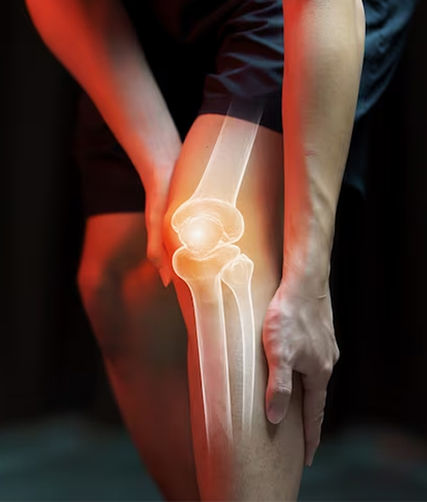 Knee-Pain-Conditions
